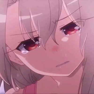 4个月娃诡异美瞳确诊青光眼
